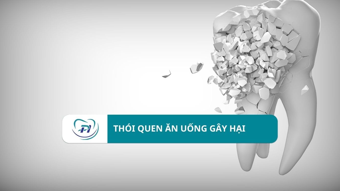 4 thói quen ăn uống gây hại cho răng